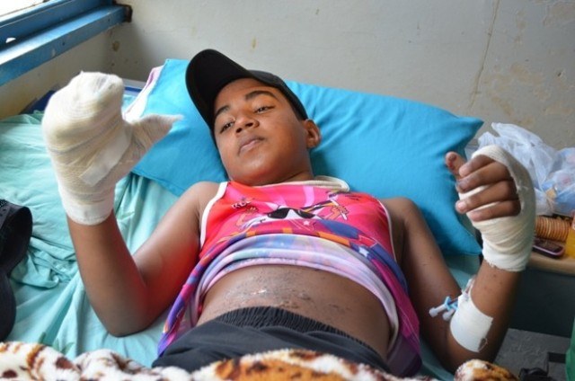 Vilhena: menino de 14 anos perde parte da mão ao soltar rojões no Natal