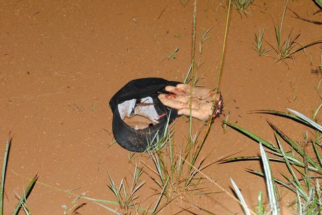 Mistério cerca caso de caminhoneiro que teve mão decepada em Vilhena