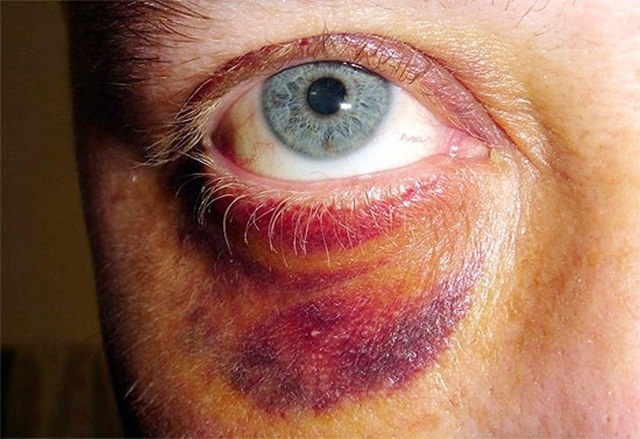 Em Vilhena, viúva denuncia empresário na polícia e diz que foi agredida