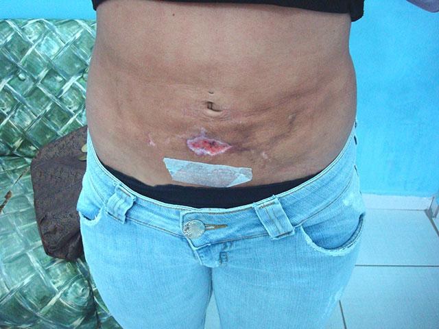 ESTUDANTE MOSTRA RESULTADO DE “HIDROLIPO” REALIZADA EM CACOAL