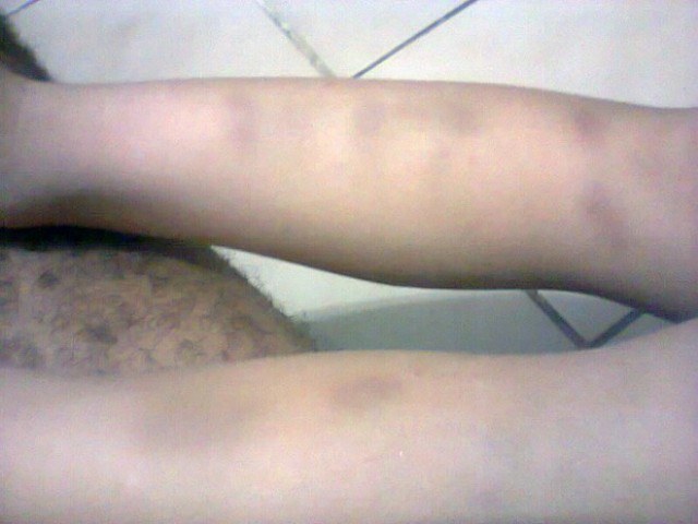 AGRESSÃO NA ESCOLA
