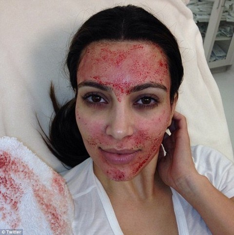 Kim Kardashian faz procedimento estético bizarro