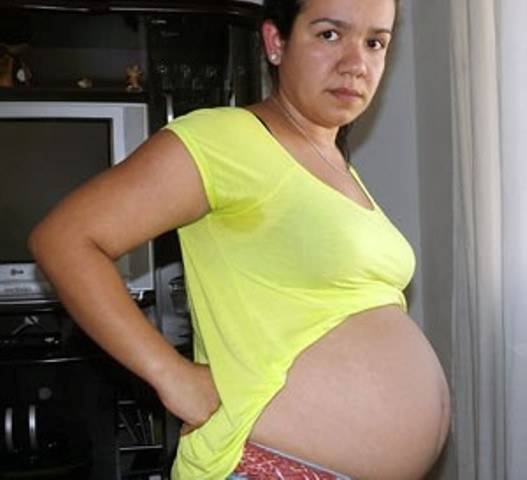 CISTO GIGANTE
