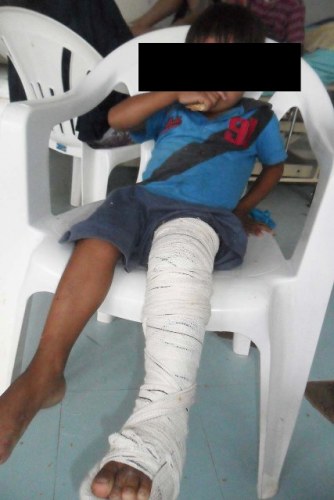 Agredido pela própria mãe, indiozinho de 4 anos é internado em Vilhena