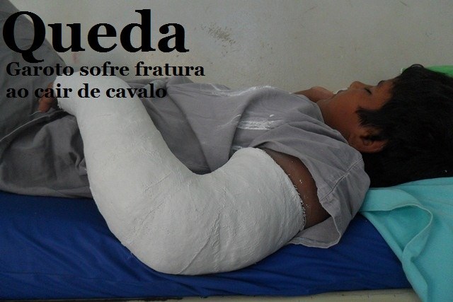 Menino fratura braço depois de cair de cavalo cego na zona rural de Colorado 