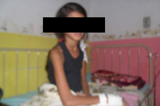 Menina de 10 anos é vítima de moléstia que já devia estar erradicada em Vilhena