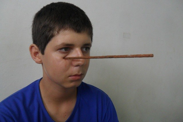 Após discussão, menino de 9 anos crava bastão de ferro no rosto de adolescente