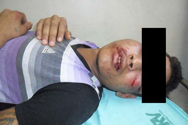 Espancado, menor é encontrado desmaiado; motivo da agressão é inusitado