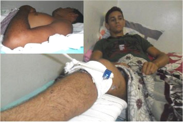 Amigos se perdem indo para festa e se reencontram feridos em hospital de Vilhena