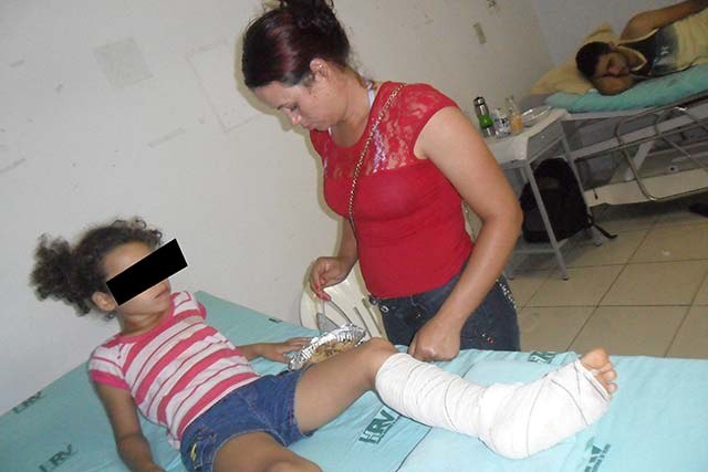 Menina de 7 anos fratura perna em brincadeira de “mau gosto” com outra de 9