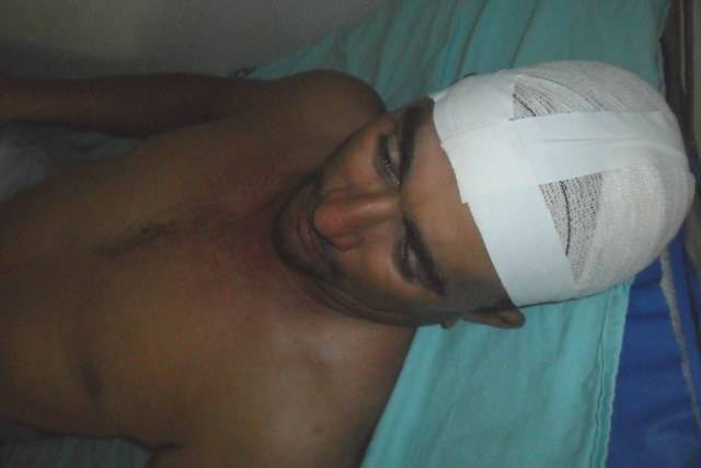 Atacado a golpes de enxada, operário escapa da morte graças à ação de colegas