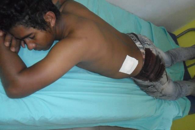 Rapaz tenta socorrer amigo, leva facada em rodeio e não sabe quem lhe atacou