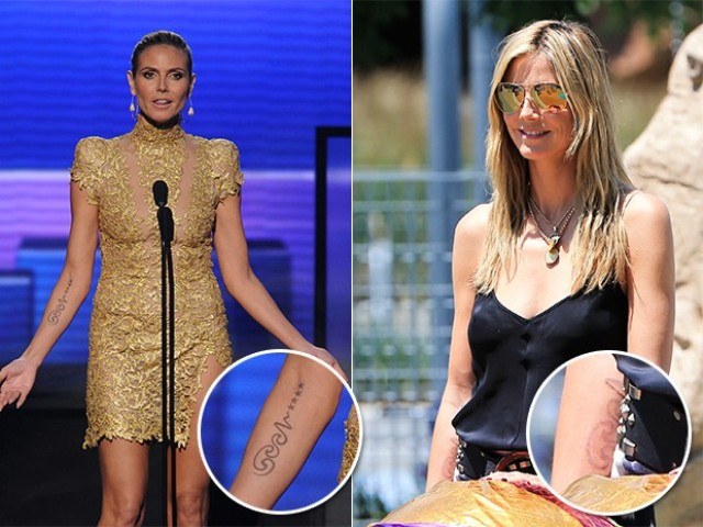 Heidi Klum está apagando tatuagem que fez para ex-marido