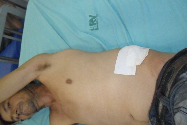 Ferido a facada, homem dá entrada no Regional e se recusa a denunciar agressor