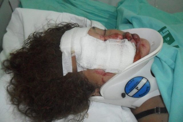Casal capota moto e menino de 3 anos que viajava sem capacete sobrevive