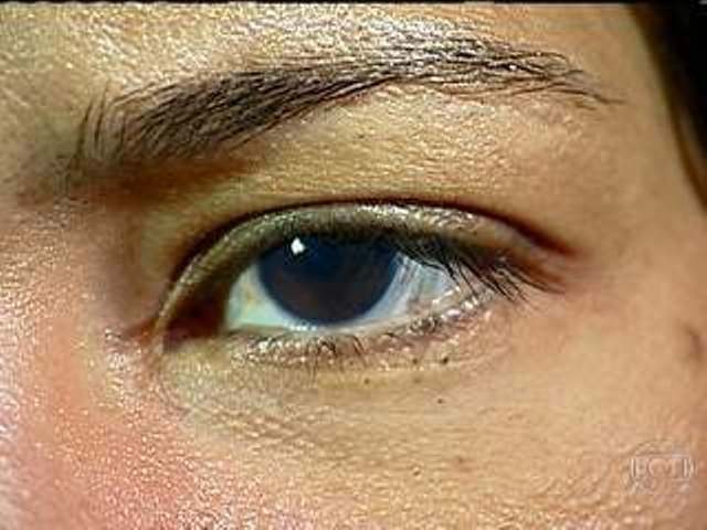 MUDANÇA NOS OLHOS