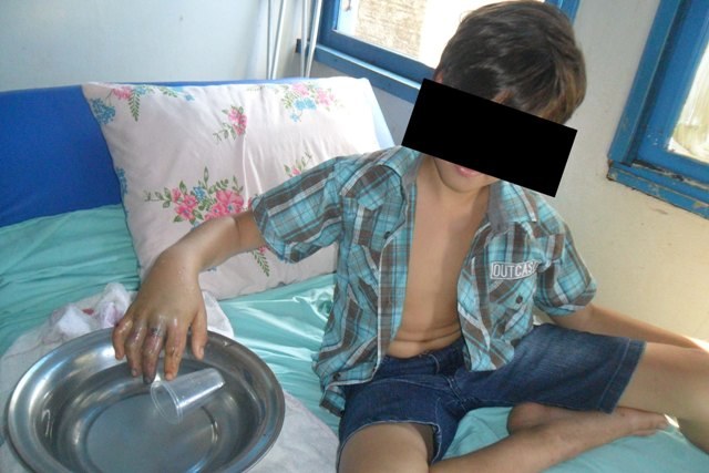 Menina de 7 anos evita que primo de 11 perca a mão em engenho de cana