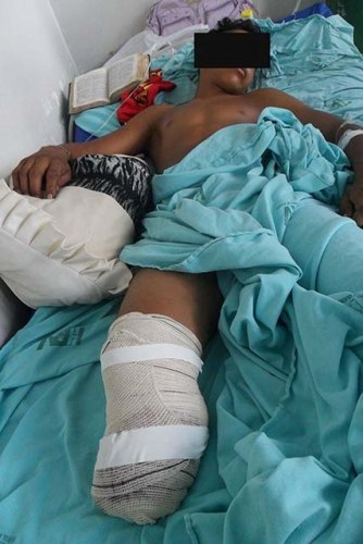 Adolescente de 15 anos tem perna amputada por trator em fazenda de Vilhena 