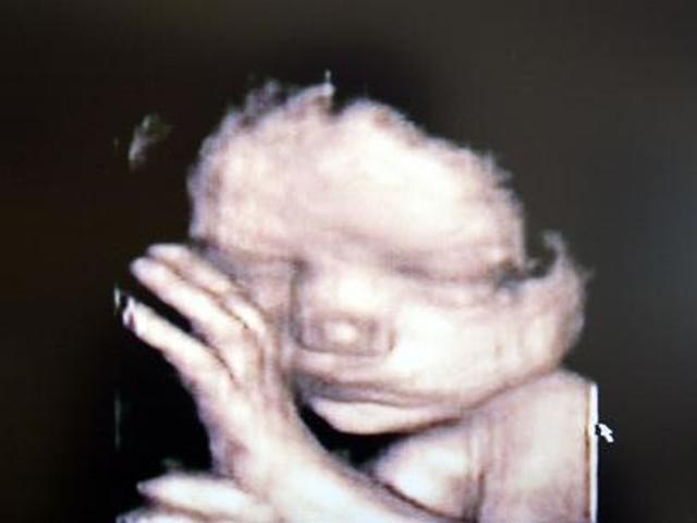 COMA BEM MAMÃE