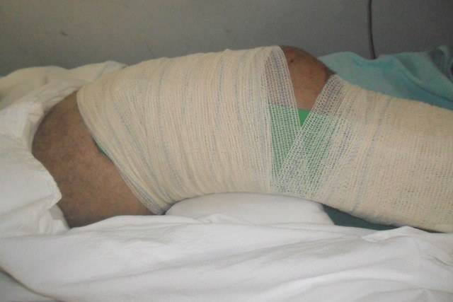 Em Cerejeiras, picape atinge moto e vendedor com fratura é trazido para Vilhena