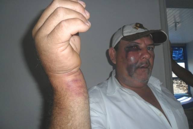 Sitiante é agredido por vizinhos, mas polícia consegue evitar assassinato