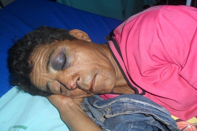 Ambulância atropela capivara e paciente que vinha para Vilhena não resiste