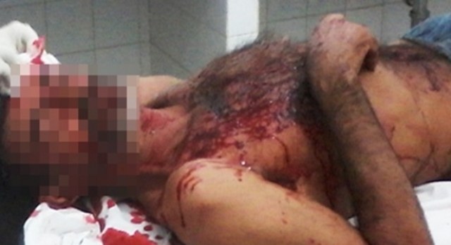 Peão irrita colegas em fazenda e vem parar em Vilhena com traumatismo craniano