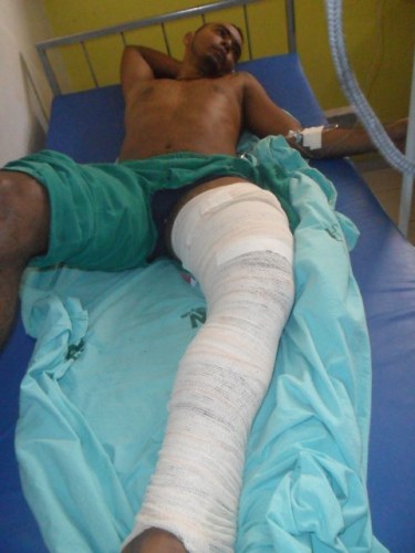 Jovem que “voou” sobre viatura do GOE em Vilhena dá detalhes do acidente