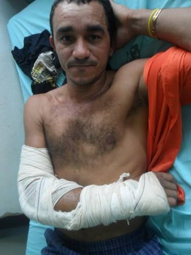 Galho fere trabalhador, que viaja mais de mil km para ser atendido em Vilhena