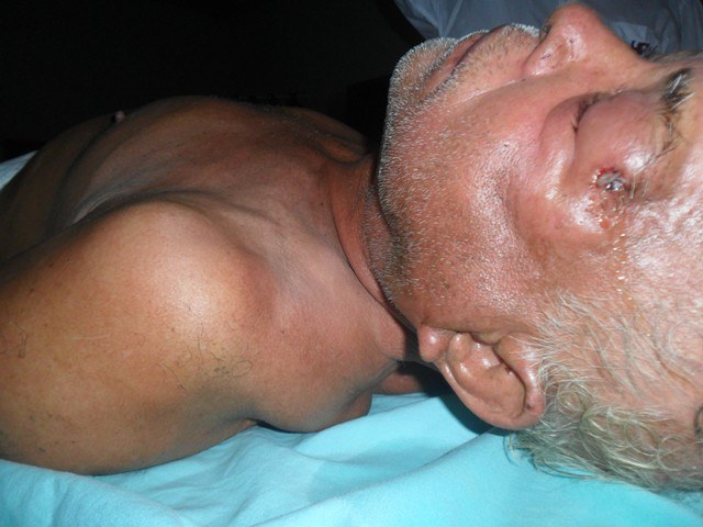 Tio do ex-prefeito Melki Donadon é encontrado ferido e inconsciente em Vilhena