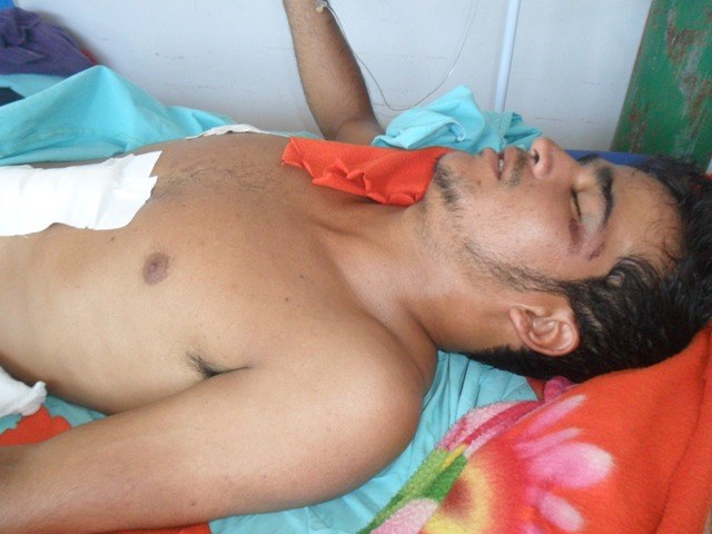 Jovem é operado em Vilhena após ser atingido por queda de árvore no MT
