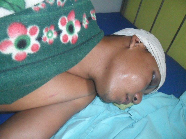 Homem passa 18 horas inconsciente ao ser agredido por cunhado em Corumbiara