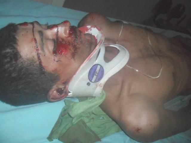 Atropelado, ciclista de 23 anos continua internado em hospital de Vilhena