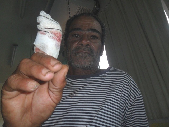 Trabalhador tem dedo amputado ao desarmar arquibancada de rodeio em Cerejeiras
