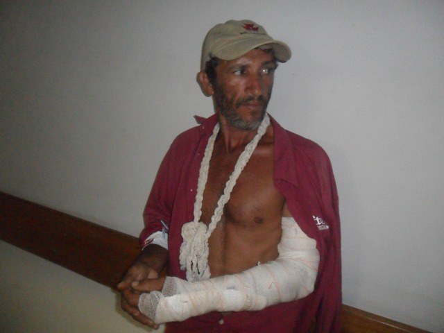 Pássaro assusta cavalo e vaqueiro leva a pior: cai e fratura braço em Cerejeiras