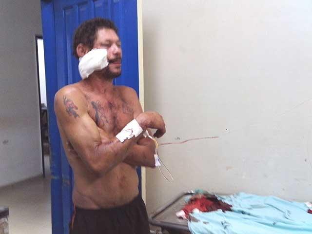 BRAÇAL ATACA TRATORISTA A GOLPES DE FACÃO