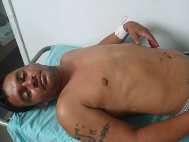 Em Pimenteiras, homem de 28 anos tenta se matar a golpes de faca em bar