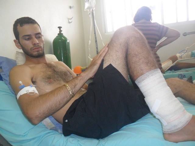 Picado por cobra venenosa, rapaz é salvo da morte por socorro rápido em Cabixi