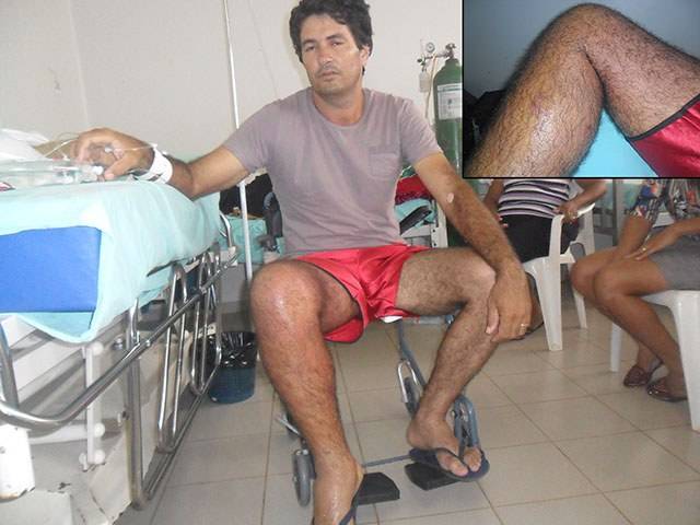 Cobra Jararacuçú faz nova vítima na região; ataque desta vez foi em Chupinguaia