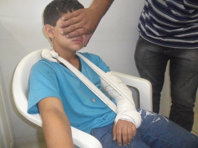 Só este ano três crianças sofreram fraturas em escola rural de Colorado do Oeste