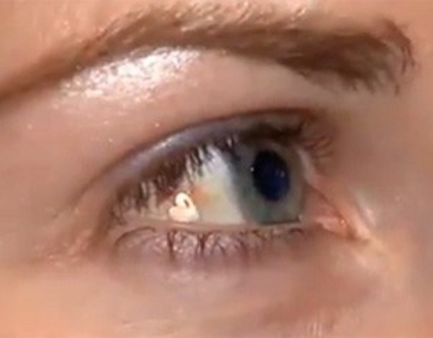 Á VISTA