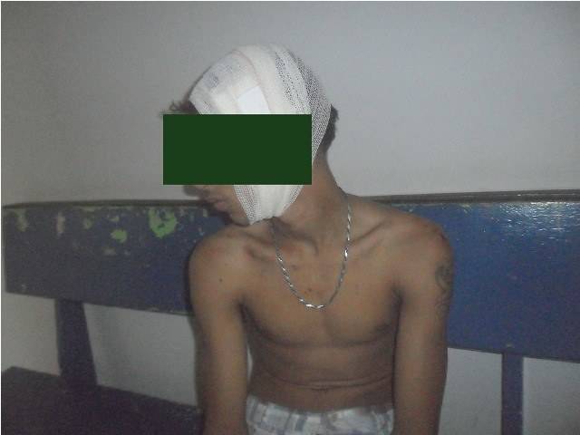 Garoto de 16 anos ataca meio-irmão a golpes de facão na periferia de Vilhena