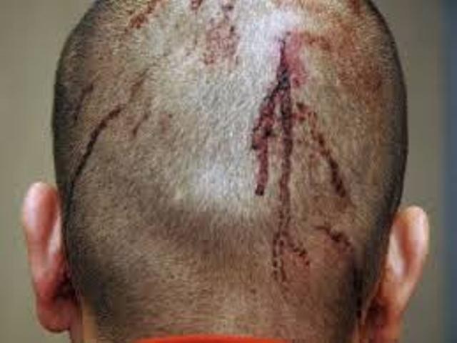 Homem é espancado na zona rural de Cerejeiras após mostrar pênis em bar
