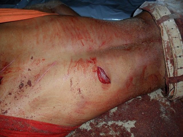 Homem é esfaqueado no distrito do Guaporé e mulher é a principal suspeita 