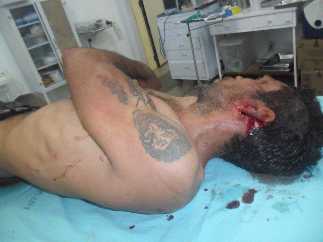 Em Vilhena, homem de 38 anos leva mais de dez facadas e sobrevive 