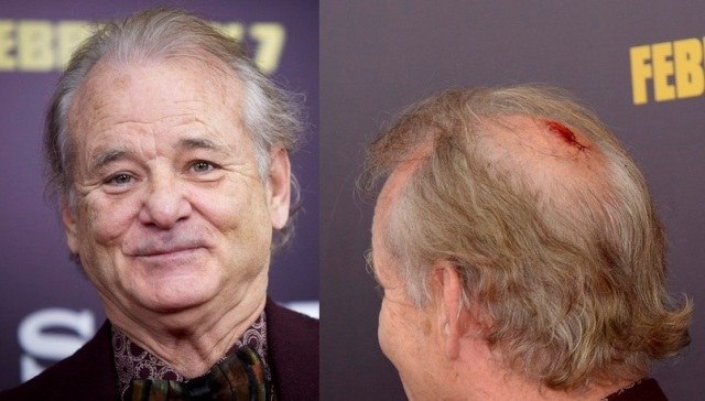 Bill Murray é fotografado com a cabeça sangrando em première