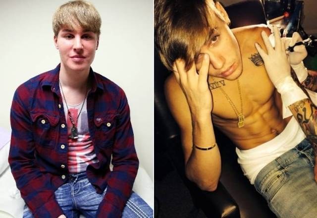 Americano de 33 anos quer ficar igual Justin Bieber e gasta R$ 240 mil em plásti