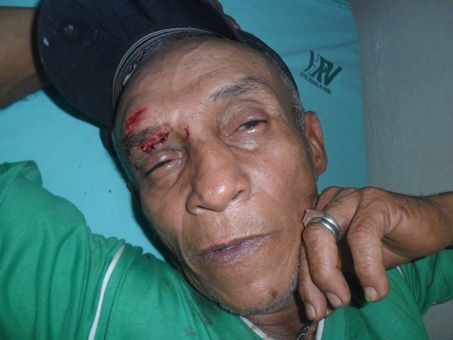 Idosa pode ter sido pivô do espancamento de homem de 72 anos em Vilhena