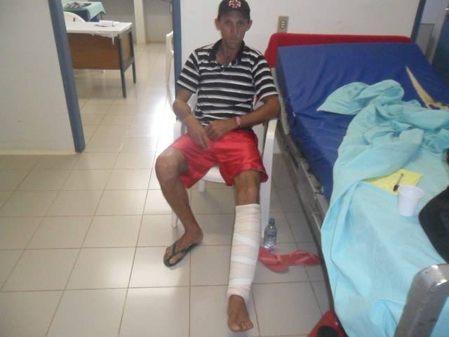 Sitiante-goleiro fratura a perna para evitar derrota de time em campeonato
