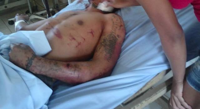 Comerciante é atacado a tiros e facadas em Cabixi e não sabe quem é o agressor